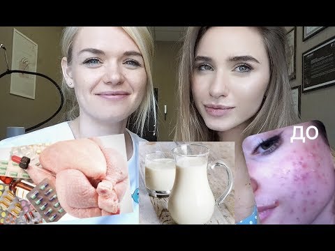 takoe ot vode dieta prishey na izvinyayus no Диета от прыщей на воде фото