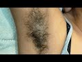 Armpit shaving by straight razor/#shaving #pammibeautyworld#waxing #shave #wax @rajlaxmivlogs1997