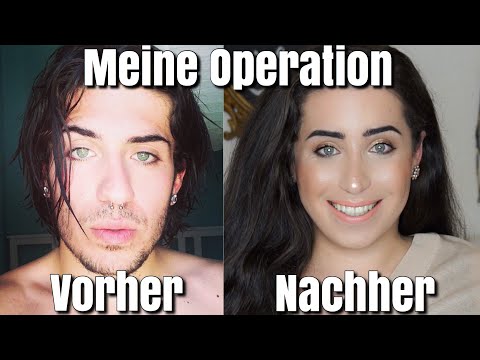 Transgender mann zu frau vorher nachher