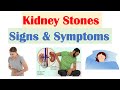 Kidney Stones (Nephrolithiasis) Signs & Symptoms | & Why They Occur