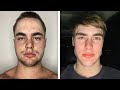 I'm an average looking guy that tried 'Looksmaxxing' | 30 Day Update