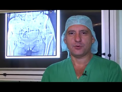 операции по замене сустава в барнауле операции по замене сустава в барнауле