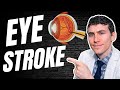 EYE STROKE - Retinal Vein Occlusion (Causes, Symptoms, Treatment)