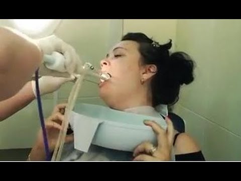 Как в домашних условиях промыть лакуны 707