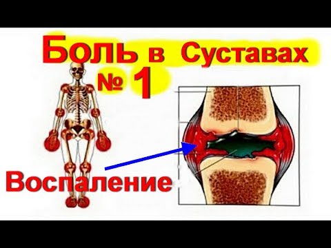 пневмония боль в суставах пневмония боль в суставах