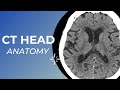 CT head anatomy for Medical students , residents and clinicians.