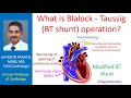 What is Blalock - Taussig (BT shunt) operation?