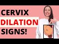 CERVIX DILATION SYMPTOMS - WHAT DOES CERVICAL DILATION FEEL LIKE AND HOW TO TELL IF YOU ARE DILATED