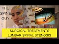 Part 3 - Surgical Treatments for Lumbar Spinal Stenosis