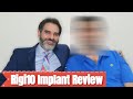Rigi10 Implant Review | successful penile implant of Canadian patient