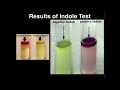 Microbiology: Indole Test (Tryptophanase)