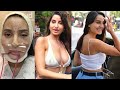 Nora Fatehi Plastic Surgery gone horribly WRONG, looking Unrecognizable