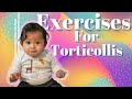 Exercises for Torticollis/ Stretches for torticollis// Baby with Right tightness.