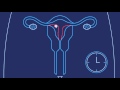 How Do You Get Pregnant? | Planned Parenthood Video