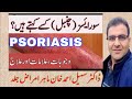 Psoriasis | Psoriasis Treatment | Chambal ka ilaj | Chambal Treatment |کیا چنبل کا مستقل علاج ہے ؟