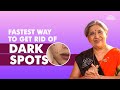 Best Ways To Lighten Your Dark Spots | Dr. Hansaji