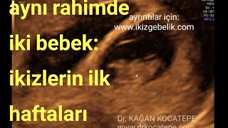Aynı rahimde iki bebek. 8 haftalık ikizlerin kalp atışları ve görüntüleri.