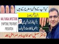 Nail Fungus | Nail Fungus Treatment for | Nail Infection | Fungal infection Nails | Onychomycosis