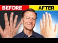The Ultimate Hand Transformation – Dr. Berg's Best Remedy for Dryness and Wrinkles