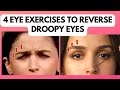 4 Anti Aging Eye Exercises That Can Reverse Alia Bhatt's DROOPY EYELIDS