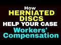 A Herniated Disc Diagnosis Makes a Workers' Compensation Case Stronger
