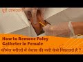 How to remove Foley catheter in female patients || फीमेल मरीजों की पेशाब की नली को केसे निकालते है?