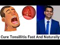 How To Cure Tonsillitis Fast And Naturally /Powerful Home Remedies For Tonsil Stones That Works Fast