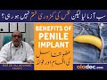 Penile Implant Kia Hota Ha - Nafs Ki Kamzori Ka Ilaj - Types Of Penile Implants And Benefits In Urdu