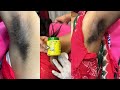 Armpit waxing by Rica wax/Rica wax ko kaise use karna hai/#wax#waxing #waxingtips #ricawax#armpitwax