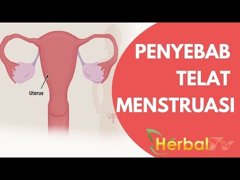 Download Bukannya Hamil, Ini 5 Penyebab Kamu Telat Menstruasi | Reasons Your Period Might Be Late free