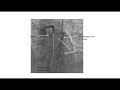 Coronary angiographic views- Elias Hanna