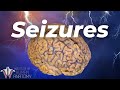 What's Actually Happening During a Seizure