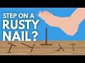 What Happens When You Step On A Rusty Nail? - Dear Blocko #13