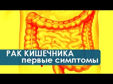 Тест рак кишечника в домашних условиях