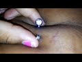 Three Month Belly Button Piercing Update editorial By : Brownie