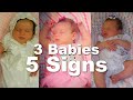 Signs of Autism in Babies Under 1| 3 Sisters| 5 Signs