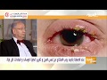 تعرف على أسباب رمد العين و طرق العلاج السريع مع الدكتور ياسر - #مستشفى الزهراء دبي