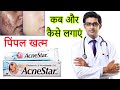 Acnestar gel HONEST review in  hindi | Acnestar gel results, benefits, uses, price info.