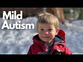 Diagnosis of Mild Autism in 2-year-old