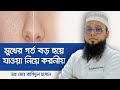 Open pores treatment bangla - Open pores on face treatment - মুখের গর্ত দূর করার উপায়