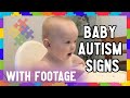 VERY EARLY AUTISM SIGNS IN BABY | 0-12 Months old | Aussie Autism Family