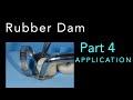 Rubber Dam Isolation, Part 4: Basic Technique for Rubber Dam Application