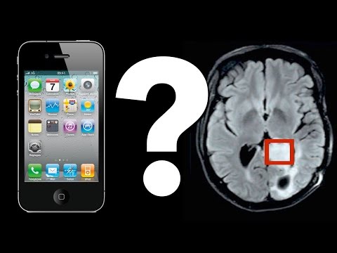 Do Cell Phones Cause Brain Tumors 