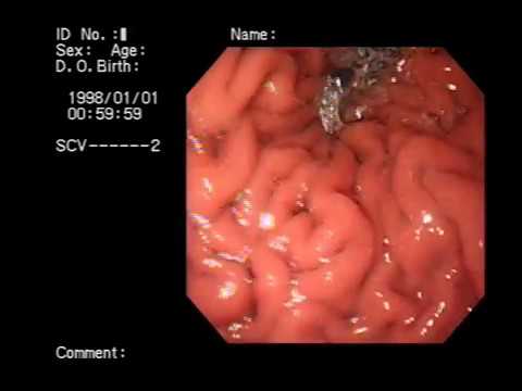 inside out makemkv segment map inside out makemkv segment map