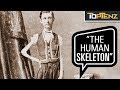 P. T. Barnum’s 10 Most Famous Human “Freak” Show Attractions
