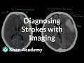 Diagnosing strokes with imaging CT, MRI, and Angiography | NCLEX-RN | Khan Academy