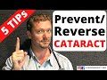 Prevent/Reverse CATARACTS with These 5 Tips
