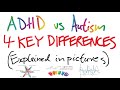 Attention Regulation: The Difference Between ADHD and Autism (Explaining The Neurodiversity Rainbow)