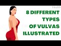 8 Different Types Of Vulvas—Illustrated