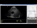 UroScan Training Video